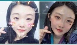 长春铭医整形最新爆料